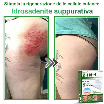 𝐇𝐮𝐝𝐫𝐨𝐬® 🧑‍⚕️2️⃣𝐂𝐞𝐫𝐨𝐭𝐭𝐢 𝐢𝐝𝐫𝐨𝐜𝐨𝐥𝐥𝐨𝐢𝐝𝐚𝐥𝐢 𝐜𝐨𝐧 𝐦𝐢𝐜𝐫𝐨𝐚𝐠𝐡𝐢 𝟐 𝐢𝐧 𝟏 | 𝐀𝐩𝐩𝐨𝐬𝐢𝐭𝐚𝐦𝐞𝐧𝐭𝐞 𝐬𝐯𝐢𝐥𝐮𝐩𝐩𝐚𝐭𝐢 𝐩𝐞𝐫 𝐥𝐚 𝐫𝐢𝐦𝐨𝐳𝐢𝐨𝐧𝐞 𝐝𝐢 𝐧𝐞𝐢 𝐬𝐩𝐨𝐫𝐠𝐞𝐧𝐭𝐢, 𝐚𝐜𝐧𝐞, 𝐯𝐞𝐫𝐫𝐮𝐜𝐡𝐞 𝐩𝐢𝐚𝐧𝐞 𝐞 𝐞𝐬𝐜𝐫𝐞𝐬𝐜𝐞𝐧𝐳𝐞 𝐜𝐮𝐭𝐚𝐧𝐞𝐞 | 𝐂𝐨𝐧𝐟𝐞𝐳𝐢𝐨𝐧𝐞 𝐝𝐚 𝟏𝟒𝟒 𝐩𝐞𝐳𝐳𝐢🪻