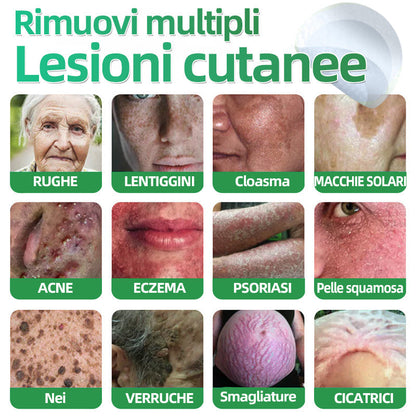 𝐇𝐮𝐝𝐫𝐨𝐬® 🧑‍⚕️2️⃣𝐂𝐞𝐫𝐨𝐭𝐭𝐢 𝐢𝐝𝐫𝐨𝐜𝐨𝐥𝐥𝐨𝐢𝐝𝐚𝐥𝐢 𝐜𝐨𝐧 𝐦𝐢𝐜𝐫𝐨𝐚𝐠𝐡𝐢 𝟐 𝐢𝐧 𝟏 | 𝐀𝐩𝐩𝐨𝐬𝐢𝐭𝐚𝐦𝐞𝐧𝐭𝐞 𝐬𝐯𝐢𝐥𝐮𝐩𝐩𝐚𝐭𝐢 𝐩𝐞𝐫 𝐥𝐚 𝐫𝐢𝐦𝐨𝐳𝐢𝐨𝐧𝐞 𝐝𝐢 𝐧𝐞𝐢 𝐬𝐩𝐨𝐫𝐠𝐞𝐧𝐭𝐢, 𝐚𝐜𝐧𝐞, 𝐯𝐞𝐫𝐫𝐮𝐜𝐡𝐞 𝐩𝐢𝐚𝐧𝐞 𝐞 𝐞𝐬𝐜𝐫𝐞𝐬𝐜𝐞𝐧𝐳𝐞 𝐜𝐮𝐭𝐚𝐧𝐞𝐞 | 𝐂𝐨𝐧𝐟𝐞𝐳𝐢𝐨𝐧𝐞 𝐝𝐚 𝟏𝟒𝟒 𝐩𝐞𝐳𝐳𝐢🪻