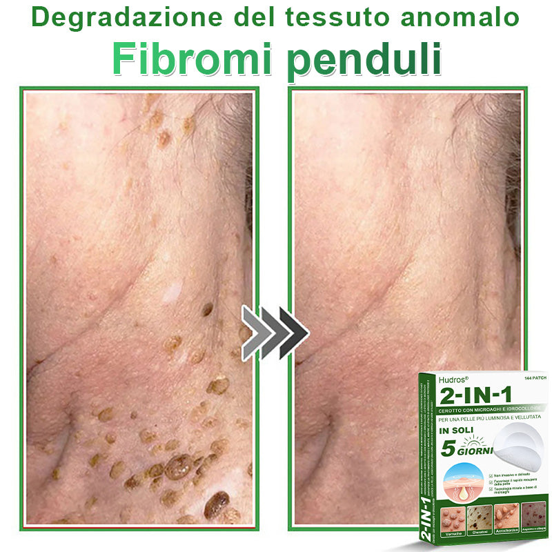 𝐇𝐮𝐝𝐫𝐨𝐬® 🧑‍⚕️2️⃣𝐂𝐞𝐫𝐨𝐭𝐭𝐢 𝐢𝐝𝐫𝐨𝐜𝐨𝐥𝐥𝐨𝐢𝐝𝐚𝐥𝐢 𝐜𝐨𝐧 𝐦𝐢𝐜𝐫𝐨𝐚𝐠𝐡𝐢 𝟐 𝐢𝐧 𝟏 | 𝐀𝐩𝐩𝐨𝐬𝐢𝐭𝐚𝐦𝐞𝐧𝐭𝐞 𝐬𝐯𝐢𝐥𝐮𝐩𝐩𝐚𝐭𝐢 𝐩𝐞𝐫 𝐥𝐚 𝐫𝐢𝐦𝐨𝐳𝐢𝐨𝐧𝐞 𝐝𝐢 𝐧𝐞𝐢 𝐬𝐩𝐨𝐫𝐠𝐞𝐧𝐭𝐢, 𝐚𝐜𝐧𝐞, 𝐯𝐞𝐫𝐫𝐮𝐜𝐡𝐞 𝐩𝐢𝐚𝐧𝐞 𝐞 𝐞𝐬𝐜𝐫𝐞𝐬𝐜𝐞𝐧𝐳𝐞 𝐜𝐮𝐭𝐚𝐧𝐞𝐞 | 𝐂𝐨𝐧𝐟𝐞𝐳𝐢𝐨𝐧𝐞 𝐝𝐚 𝟏𝟒𝟒 𝐩𝐞𝐳𝐳𝐢🪻