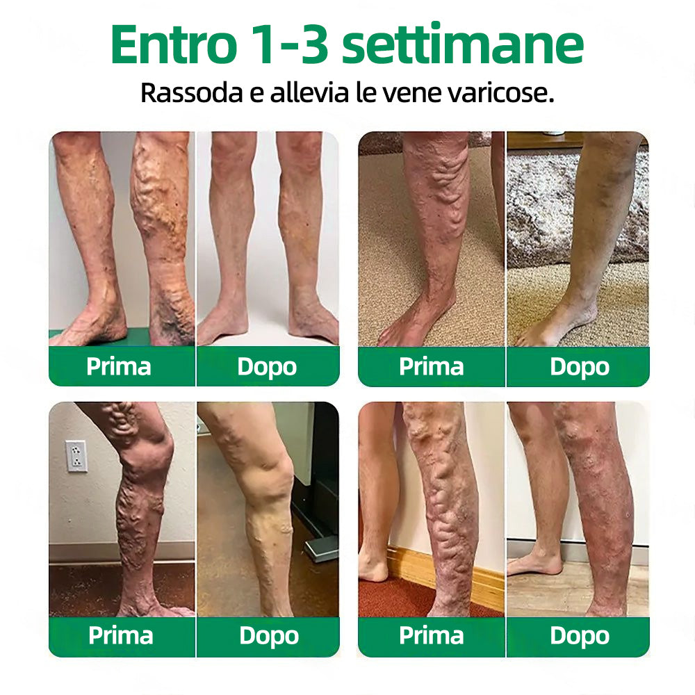 👨‍⚕️✅ Healrize® VeinTarget Cerotto a Microagopuntura⚡Sollievo Immediato, Risultati Duraturi❄️
