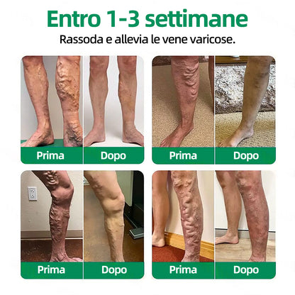 👨‍⚕️✅ Healrize® VeinTarget Cerotto a Microagopuntura⚡Sollievo Immediato, Risultati Duraturi❄️