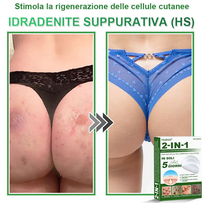 𝐇𝐮𝐝𝐫𝐨𝐬® 🧑‍⚕️2️⃣𝐂𝐞𝐫𝐨𝐭𝐭𝐢 𝐢𝐝𝐫𝐨𝐜𝐨𝐥𝐥𝐨𝐢𝐝𝐚𝐥𝐢 𝐜𝐨𝐧 𝐦𝐢𝐜𝐫𝐨𝐚𝐠𝐡𝐢 𝟐 𝐢𝐧 𝟏 | 𝐀𝐩𝐩𝐨𝐬𝐢𝐭𝐚𝐦𝐞𝐧𝐭𝐞 𝐬𝐯𝐢𝐥𝐮𝐩𝐩𝐚𝐭𝐢 𝐩𝐞𝐫 𝐥𝐚 𝐫𝐢𝐦𝐨𝐳𝐢𝐨𝐧𝐞 𝐝𝐢 𝐧𝐞𝐢 𝐬𝐩𝐨𝐫𝐠𝐞𝐧𝐭𝐢, 𝐚𝐜𝐧𝐞, 𝐯𝐞𝐫𝐫𝐮𝐜𝐡𝐞 𝐩𝐢𝐚𝐧𝐞 𝐞 𝐞𝐬𝐜𝐫𝐞𝐬𝐜𝐞𝐧𝐳𝐞 𝐜𝐮𝐭𝐚𝐧𝐞𝐞 | 𝐂𝐨𝐧𝐟𝐞𝐳𝐢𝐨𝐧𝐞 𝐝𝐚 𝟏𝟒𝟒 𝐩𝐞𝐳𝐳𝐢🪻