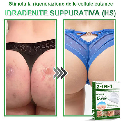 𝐇𝐮𝐝𝐫𝐨𝐬® 🧑‍⚕️2️⃣𝐂𝐞𝐫𝐨𝐭𝐭𝐢 𝐢𝐝𝐫𝐨𝐜𝐨𝐥𝐥𝐨𝐢𝐝𝐚𝐥𝐢 𝐜𝐨𝐧 𝐦𝐢𝐜𝐫𝐨𝐚𝐠𝐡𝐢 𝟐 𝐢𝐧 𝟏 | 𝐀𝐩𝐩𝐨𝐬𝐢𝐭𝐚𝐦𝐞𝐧𝐭𝐞 𝐬𝐯𝐢𝐥𝐮𝐩𝐩𝐚𝐭𝐢 𝐩𝐞𝐫 𝐥𝐚 𝐫𝐢𝐦𝐨𝐳𝐢𝐨𝐧𝐞 𝐝𝐢 𝐧𝐞𝐢 𝐬𝐩𝐨𝐫𝐠𝐞𝐧𝐭𝐢, 𝐚𝐜𝐧𝐞, 𝐯𝐞𝐫𝐫𝐮𝐜𝐡𝐞 𝐩𝐢𝐚𝐧𝐞 𝐞 𝐞𝐬𝐜𝐫𝐞𝐬𝐜𝐞𝐧𝐳𝐞 𝐜𝐮𝐭𝐚𝐧𝐞𝐞 | 𝐂𝐨𝐧𝐟𝐞𝐳𝐢𝐨𝐧𝐞 𝐝𝐚 𝟏𝟒𝟒 𝐩𝐞𝐳𝐳𝐢🪻