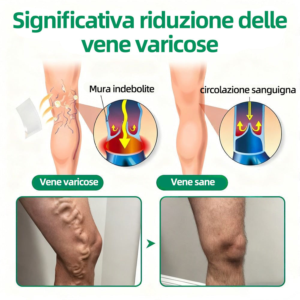 👨‍⚕️✅ Healrize® VeinTarget Cerotto a Microagopuntura⚡Sollievo Immediato, Risultati Duraturi❄️