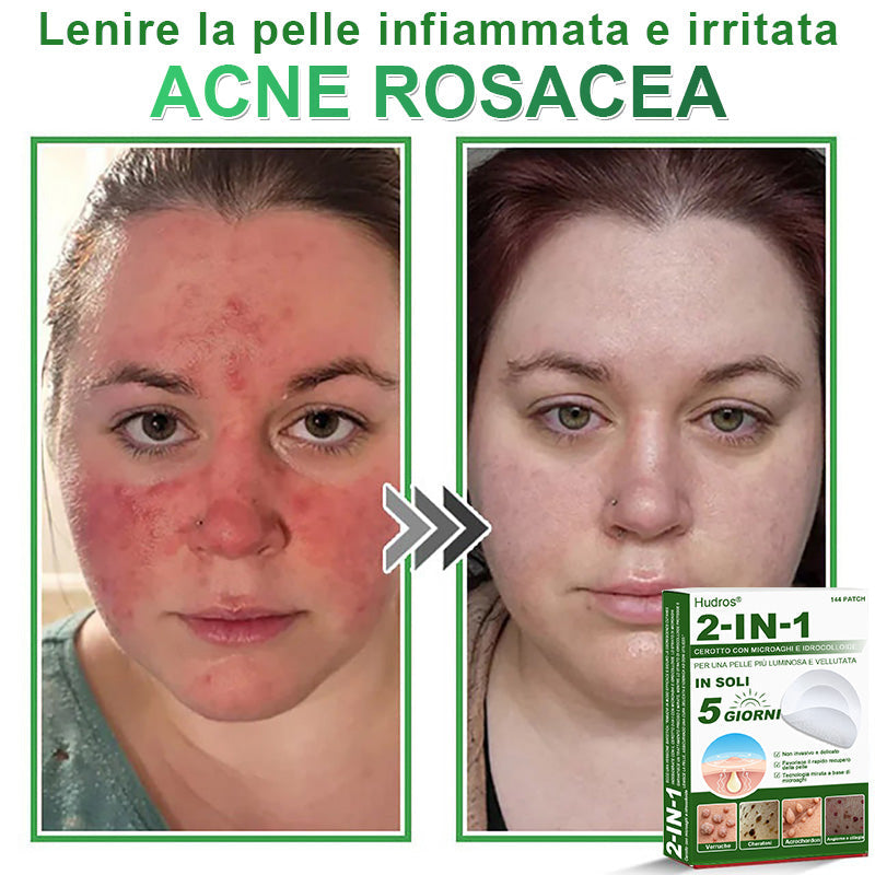 𝐇𝐮𝐝𝐫𝐨𝐬® 🧑‍⚕️2️⃣𝐂𝐞𝐫𝐨𝐭𝐭𝐢 𝐢𝐝𝐫𝐨𝐜𝐨𝐥𝐥𝐨𝐢𝐝𝐚𝐥𝐢 𝐜𝐨𝐧 𝐦𝐢𝐜𝐫𝐨𝐚𝐠𝐡𝐢 𝟐 𝐢𝐧 𝟏 | 𝐀𝐩𝐩𝐨𝐬𝐢𝐭𝐚𝐦𝐞𝐧𝐭𝐞 𝐬𝐯𝐢𝐥𝐮𝐩𝐩𝐚𝐭𝐢 𝐩𝐞𝐫 𝐥𝐚 𝐫𝐢𝐦𝐨𝐳𝐢𝐨𝐧𝐞 𝐝𝐢 𝐧𝐞𝐢 𝐬𝐩𝐨𝐫𝐠𝐞𝐧𝐭𝐢, 𝐚𝐜𝐧𝐞, 𝐯𝐞𝐫𝐫𝐮𝐜𝐡𝐞 𝐩𝐢𝐚𝐧𝐞 𝐞 𝐞𝐬𝐜𝐫𝐞𝐬𝐜𝐞𝐧𝐳𝐞 𝐜𝐮𝐭𝐚𝐧𝐞𝐞 | 𝐂𝐨𝐧𝐟𝐞𝐳𝐢𝐨𝐧𝐞 𝐝𝐚 𝟏𝟒𝟒 𝐩𝐞𝐳𝐳𝐢🪻