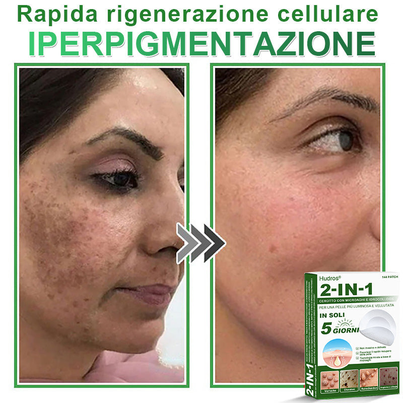 𝐇𝐮𝐝𝐫𝐨𝐬® 🧑‍⚕️2️⃣𝐂𝐞𝐫𝐨𝐭𝐭𝐢 𝐢𝐝𝐫𝐨𝐜𝐨𝐥𝐥𝐨𝐢𝐝𝐚𝐥𝐢 𝐜𝐨𝐧 𝐦𝐢𝐜𝐫𝐨𝐚𝐠𝐡𝐢 𝟐 𝐢𝐧 𝟏 | 𝐀𝐩𝐩𝐨𝐬𝐢𝐭𝐚𝐦𝐞𝐧𝐭𝐞 𝐬𝐯𝐢𝐥𝐮𝐩𝐩𝐚𝐭𝐢 𝐩𝐞𝐫 𝐥𝐚 𝐫𝐢𝐦𝐨𝐳𝐢𝐨𝐧𝐞 𝐝𝐢 𝐧𝐞𝐢 𝐬𝐩𝐨𝐫𝐠𝐞𝐧𝐭𝐢, 𝐚𝐜𝐧𝐞, 𝐯𝐞𝐫𝐫𝐮𝐜𝐡𝐞 𝐩𝐢𝐚𝐧𝐞 𝐞 𝐞𝐬𝐜𝐫𝐞𝐬𝐜𝐞𝐧𝐳𝐞 𝐜𝐮𝐭𝐚𝐧𝐞𝐞 | 𝐂𝐨𝐧𝐟𝐞𝐳𝐢𝐨𝐧𝐞 𝐝𝐚 𝟏𝟒𝟒 𝐩𝐞𝐳𝐳𝐢🪻