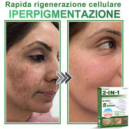 𝐇𝐮𝐝𝐫𝐨𝐬® 🧑‍⚕️2️⃣𝐂𝐞𝐫𝐨𝐭𝐭𝐢 𝐢𝐝𝐫𝐨𝐜𝐨𝐥𝐥𝐨𝐢𝐝𝐚𝐥𝐢 𝐜𝐨𝐧 𝐦𝐢𝐜𝐫𝐨𝐚𝐠𝐡𝐢 𝟐 𝐢𝐧 𝟏 | 𝐀𝐩𝐩𝐨𝐬𝐢𝐭𝐚𝐦𝐞𝐧𝐭𝐞 𝐬𝐯𝐢𝐥𝐮𝐩𝐩𝐚𝐭𝐢 𝐩𝐞𝐫 𝐥𝐚 𝐫𝐢𝐦𝐨𝐳𝐢𝐨𝐧𝐞 𝐝𝐢 𝐧𝐞𝐢 𝐬𝐩𝐨𝐫𝐠𝐞𝐧𝐭𝐢, 𝐚𝐜𝐧𝐞, 𝐯𝐞𝐫𝐫𝐮𝐜𝐡𝐞 𝐩𝐢𝐚𝐧𝐞 𝐞 𝐞𝐬𝐜𝐫𝐞𝐬𝐜𝐞𝐧𝐳𝐞 𝐜𝐮𝐭𝐚𝐧𝐞𝐞 | 𝐂𝐨𝐧𝐟𝐞𝐳𝐢𝐨𝐧𝐞 𝐝𝐚 𝟏𝟒𝟒 𝐩𝐞𝐳𝐳𝐢🪻