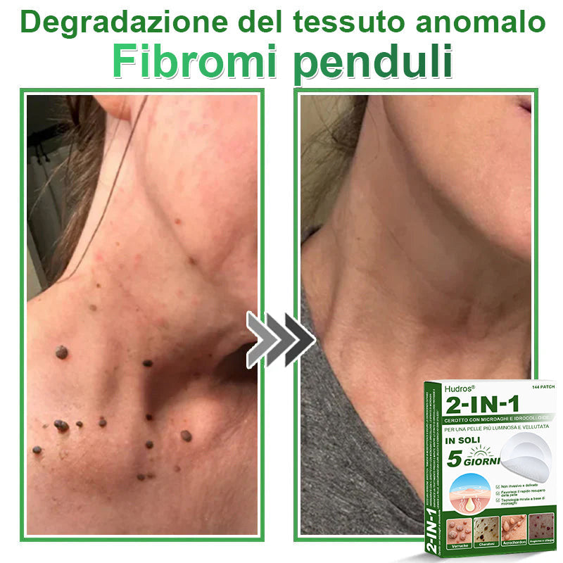𝐇𝐮𝐝𝐫𝐨𝐬® 🧑‍⚕️2️⃣𝐂𝐞𝐫𝐨𝐭𝐭𝐢 𝐢𝐝𝐫𝐨𝐜𝐨𝐥𝐥𝐨𝐢𝐝𝐚𝐥𝐢 𝐜𝐨𝐧 𝐦𝐢𝐜𝐫𝐨𝐚𝐠𝐡𝐢 𝟐 𝐢𝐧 𝟏 | 𝐀𝐩𝐩𝐨𝐬𝐢𝐭𝐚𝐦𝐞𝐧𝐭𝐞 𝐬𝐯𝐢𝐥𝐮𝐩𝐩𝐚𝐭𝐢 𝐩𝐞𝐫 𝐥𝐚 𝐫𝐢𝐦𝐨𝐳𝐢𝐨𝐧𝐞 𝐝𝐢 𝐧𝐞𝐢 𝐬𝐩𝐨𝐫𝐠𝐞𝐧𝐭𝐢, 𝐚𝐜𝐧𝐞, 𝐯𝐞𝐫𝐫𝐮𝐜𝐡𝐞 𝐩𝐢𝐚𝐧𝐞 𝐞 𝐞𝐬𝐜𝐫𝐞𝐬𝐜𝐞𝐧𝐳𝐞 𝐜𝐮𝐭𝐚𝐧𝐞𝐞 | 𝐂𝐨𝐧𝐟𝐞𝐳𝐢𝐨𝐧𝐞 𝐝𝐚 𝟏𝟒𝟒 𝐩𝐞𝐳𝐳𝐢🪻