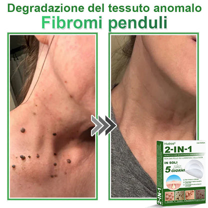 𝐇𝐮𝐝𝐫𝐨𝐬® 🧑‍⚕️2️⃣𝐂𝐞𝐫𝐨𝐭𝐭𝐢 𝐢𝐝𝐫𝐨𝐜𝐨𝐥𝐥𝐨𝐢𝐝𝐚𝐥𝐢 𝐜𝐨𝐧 𝐦𝐢𝐜𝐫𝐨𝐚𝐠𝐡𝐢 𝟐 𝐢𝐧 𝟏 | 𝐀𝐩𝐩𝐨𝐬𝐢𝐭𝐚𝐦𝐞𝐧𝐭𝐞 𝐬𝐯𝐢𝐥𝐮𝐩𝐩𝐚𝐭𝐢 𝐩𝐞𝐫 𝐥𝐚 𝐫𝐢𝐦𝐨𝐳𝐢𝐨𝐧𝐞 𝐝𝐢 𝐧𝐞𝐢 𝐬𝐩𝐨𝐫𝐠𝐞𝐧𝐭𝐢, 𝐚𝐜𝐧𝐞, 𝐯𝐞𝐫𝐫𝐮𝐜𝐡𝐞 𝐩𝐢𝐚𝐧𝐞 𝐞 𝐞𝐬𝐜𝐫𝐞𝐬𝐜𝐞𝐧𝐳𝐞 𝐜𝐮𝐭𝐚𝐧𝐞𝐞 | 𝐂𝐨𝐧𝐟𝐞𝐳𝐢𝐨𝐧𝐞 𝐝𝐚 𝟏𝟒𝟒 𝐩𝐞𝐳𝐳𝐢🪻