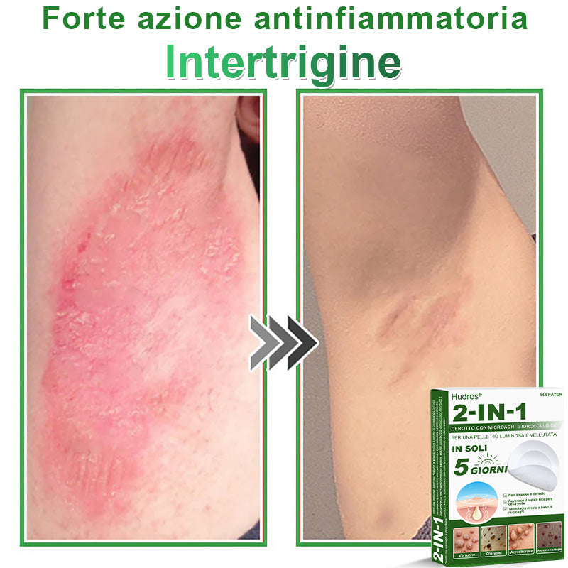 𝐇𝐮𝐝𝐫𝐨𝐬® 🧑‍⚕️2️⃣𝐂𝐞𝐫𝐨𝐭𝐭𝐢 𝐢𝐝𝐫𝐨𝐜𝐨𝐥𝐥𝐨𝐢𝐝𝐚𝐥𝐢 𝐜𝐨𝐧 𝐦𝐢𝐜𝐫𝐨𝐚𝐠𝐡𝐢 𝟐 𝐢𝐧 𝟏 | 𝐀𝐩𝐩𝐨𝐬𝐢𝐭𝐚𝐦𝐞𝐧𝐭𝐞 𝐬𝐯𝐢𝐥𝐮𝐩𝐩𝐚𝐭𝐢 𝐩𝐞𝐫 𝐥𝐚 𝐫𝐢𝐦𝐨𝐳𝐢𝐨𝐧𝐞 𝐝𝐢 𝐧𝐞𝐢 𝐬𝐩𝐨𝐫𝐠𝐞𝐧𝐭𝐢, 𝐚𝐜𝐧𝐞, 𝐯𝐞𝐫𝐫𝐮𝐜𝐡𝐞 𝐩𝐢𝐚𝐧𝐞 𝐞 𝐞𝐬𝐜𝐫𝐞𝐬𝐜𝐞𝐧𝐳𝐞 𝐜𝐮𝐭𝐚𝐧𝐞𝐞 | 𝐂𝐨𝐧𝐟𝐞𝐳𝐢𝐨𝐧𝐞 𝐝𝐚 𝟏𝟒𝟒 𝐩𝐞𝐳𝐳𝐢🪻