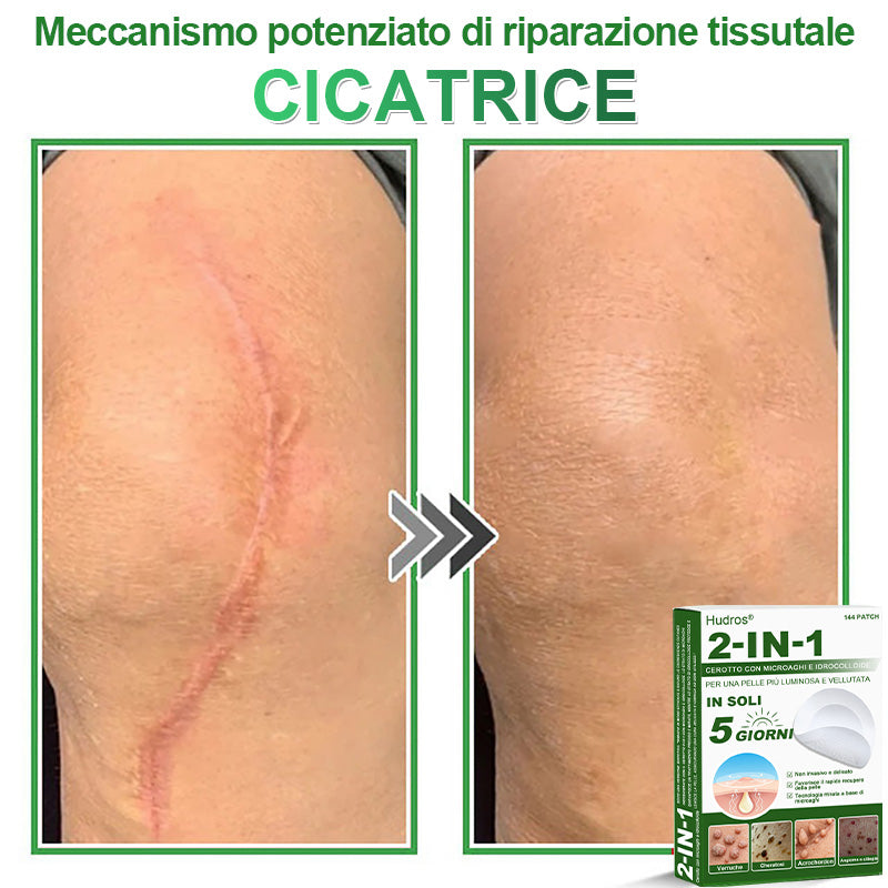 𝐇𝐮𝐝𝐫𝐨𝐬® 🧑‍⚕️2️⃣𝐂𝐞𝐫𝐨𝐭𝐭𝐢 𝐢𝐝𝐫𝐨𝐜𝐨𝐥𝐥𝐨𝐢𝐝𝐚𝐥𝐢 𝐜𝐨𝐧 𝐦𝐢𝐜𝐫𝐨𝐚𝐠𝐡𝐢 𝟐 𝐢𝐧 𝟏 | 𝐀𝐩𝐩𝐨𝐬𝐢𝐭𝐚𝐦𝐞𝐧𝐭𝐞 𝐬𝐯𝐢𝐥𝐮𝐩𝐩𝐚𝐭𝐢 𝐩𝐞𝐫 𝐥𝐚 𝐫𝐢𝐦𝐨𝐳𝐢𝐨𝐧𝐞 𝐝𝐢 𝐧𝐞𝐢 𝐬𝐩𝐨𝐫𝐠𝐞𝐧𝐭𝐢, 𝐚𝐜𝐧𝐞, 𝐯𝐞𝐫𝐫𝐮𝐜𝐡𝐞 𝐩𝐢𝐚𝐧𝐞 𝐞 𝐞𝐬𝐜𝐫𝐞𝐬𝐜𝐞𝐧𝐳𝐞 𝐜𝐮𝐭𝐚𝐧𝐞𝐞 | 𝐂𝐨𝐧𝐟𝐞𝐳𝐢𝐨𝐧𝐞 𝐝𝐚 𝟏𝟒𝟒 𝐩𝐞𝐳𝐳𝐢🪻