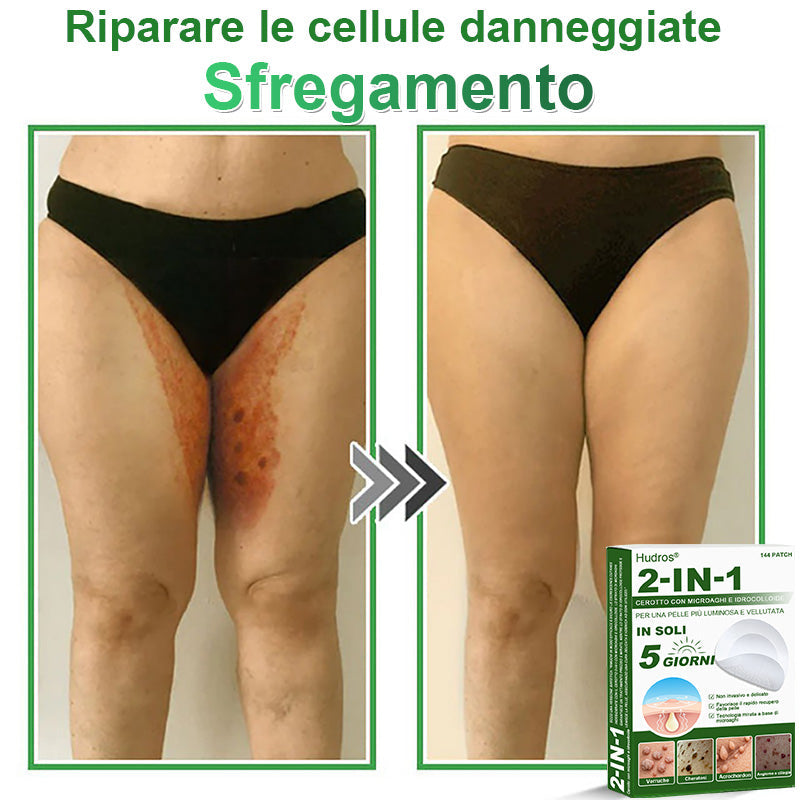 𝐇𝐮𝐝𝐫𝐨𝐬® 🧑‍⚕️2️⃣𝐂𝐞𝐫𝐨𝐭𝐭𝐢 𝐢𝐝𝐫𝐨𝐜𝐨𝐥𝐥𝐨𝐢𝐝𝐚𝐥𝐢 𝐜𝐨𝐧 𝐦𝐢𝐜𝐫𝐨𝐚𝐠𝐡𝐢 𝟐 𝐢𝐧 𝟏 | 𝐀𝐩𝐩𝐨𝐬𝐢𝐭𝐚𝐦𝐞𝐧𝐭𝐞 𝐬𝐯𝐢𝐥𝐮𝐩𝐩𝐚𝐭𝐢 𝐩𝐞𝐫 𝐥𝐚 𝐫𝐢𝐦𝐨𝐳𝐢𝐨𝐧𝐞 𝐝𝐢 𝐧𝐞𝐢 𝐬𝐩𝐨𝐫𝐠𝐞𝐧𝐭𝐢, 𝐚𝐜𝐧𝐞, 𝐯𝐞𝐫𝐫𝐮𝐜𝐡𝐞 𝐩𝐢𝐚𝐧𝐞 𝐞 𝐞𝐬𝐜𝐫𝐞𝐬𝐜𝐞𝐧𝐳𝐞 𝐜𝐮𝐭𝐚𝐧𝐞𝐞 | 𝐂𝐨𝐧𝐟𝐞𝐳𝐢𝐨𝐧𝐞 𝐝𝐚 𝟏𝟒𝟒 𝐩𝐞𝐳𝐳𝐢🪻