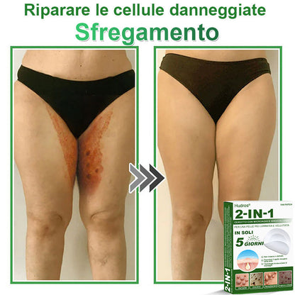 𝐇𝐮𝐝𝐫𝐨𝐬® 🧑‍⚕️2️⃣𝐂𝐞𝐫𝐨𝐭𝐭𝐢 𝐢𝐝𝐫𝐨𝐜𝐨𝐥𝐥𝐨𝐢𝐝𝐚𝐥𝐢 𝐜𝐨𝐧 𝐦𝐢𝐜𝐫𝐨𝐚𝐠𝐡𝐢 𝟐 𝐢𝐧 𝟏 | 𝐀𝐩𝐩𝐨𝐬𝐢𝐭𝐚𝐦𝐞𝐧𝐭𝐞 𝐬𝐯𝐢𝐥𝐮𝐩𝐩𝐚𝐭𝐢 𝐩𝐞𝐫 𝐥𝐚 𝐫𝐢𝐦𝐨𝐳𝐢𝐨𝐧𝐞 𝐝𝐢 𝐧𝐞𝐢 𝐬𝐩𝐨𝐫𝐠𝐞𝐧𝐭𝐢, 𝐚𝐜𝐧𝐞, 𝐯𝐞𝐫𝐫𝐮𝐜𝐡𝐞 𝐩𝐢𝐚𝐧𝐞 𝐞 𝐞𝐬𝐜𝐫𝐞𝐬𝐜𝐞𝐧𝐳𝐞 𝐜𝐮𝐭𝐚𝐧𝐞𝐞 | 𝐂𝐨𝐧𝐟𝐞𝐳𝐢𝐨𝐧𝐞 𝐝𝐚 𝟏𝟒𝟒 𝐩𝐞𝐳𝐳𝐢🪻